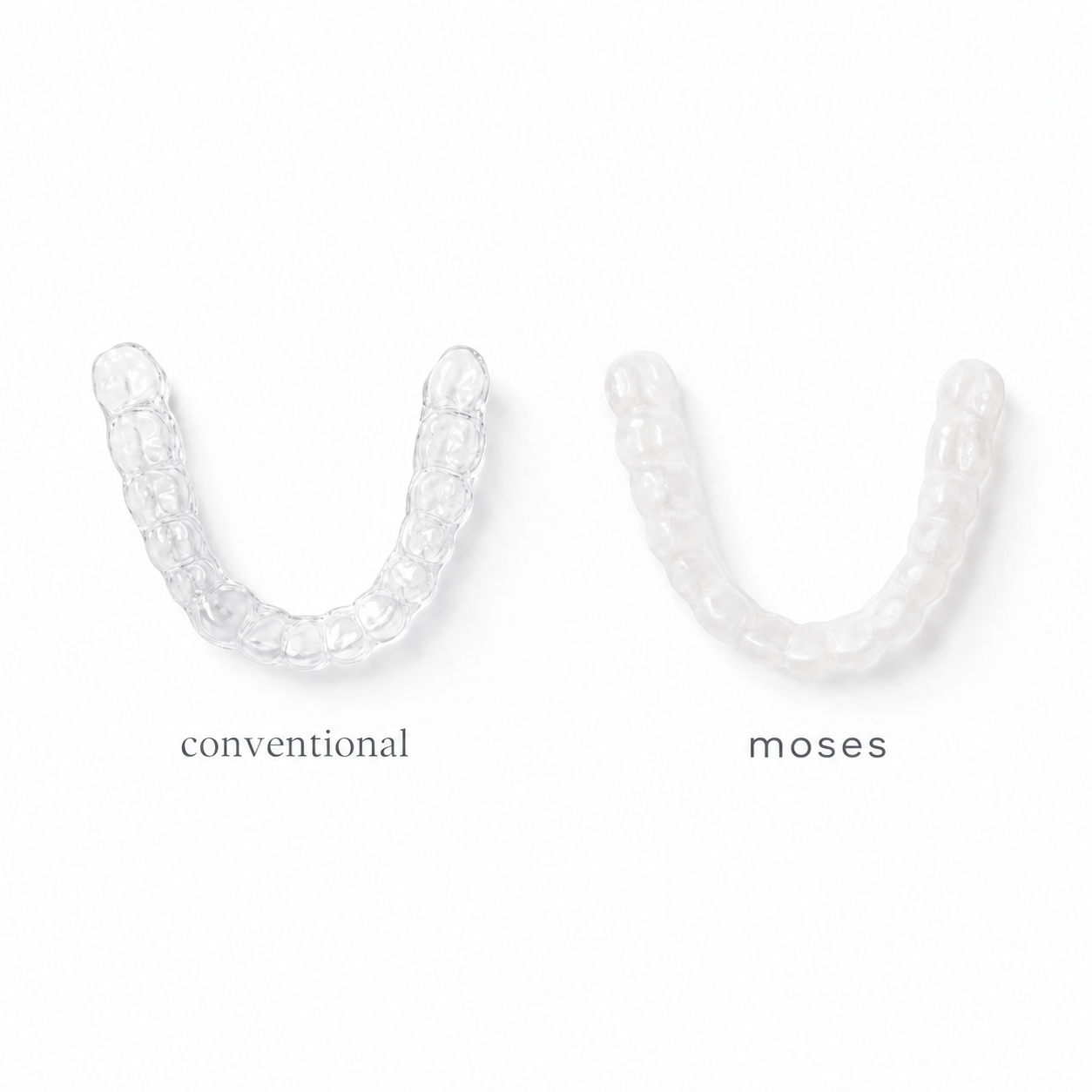 Conventional retainer compared with moses